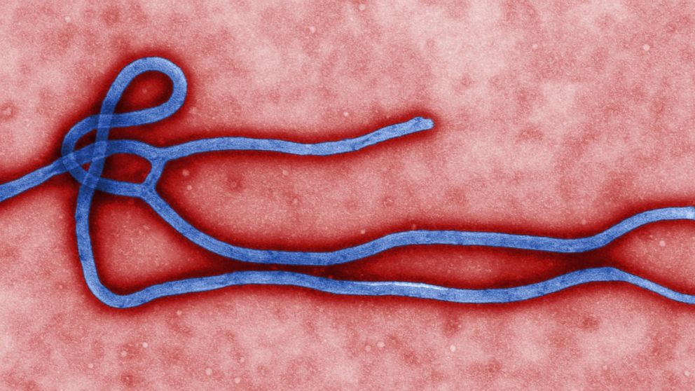 Undated file image from the  Centers for Disease Control  (CDC) shows Ebola virus