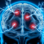 brain injury awareness